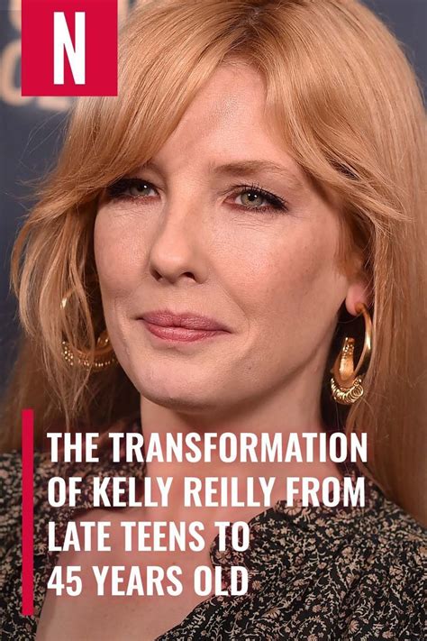 kelly reilly surgery|The Transformation Of Kelly Reilly From Late Teens。